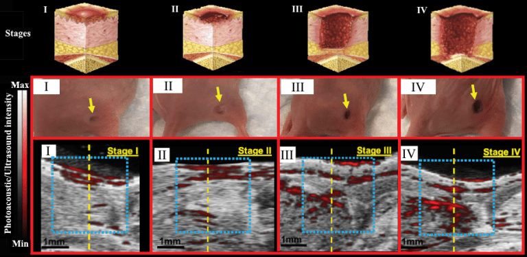 Jokerst Bioimaging Lab (UCSD) and PRL join forces to detect wounds