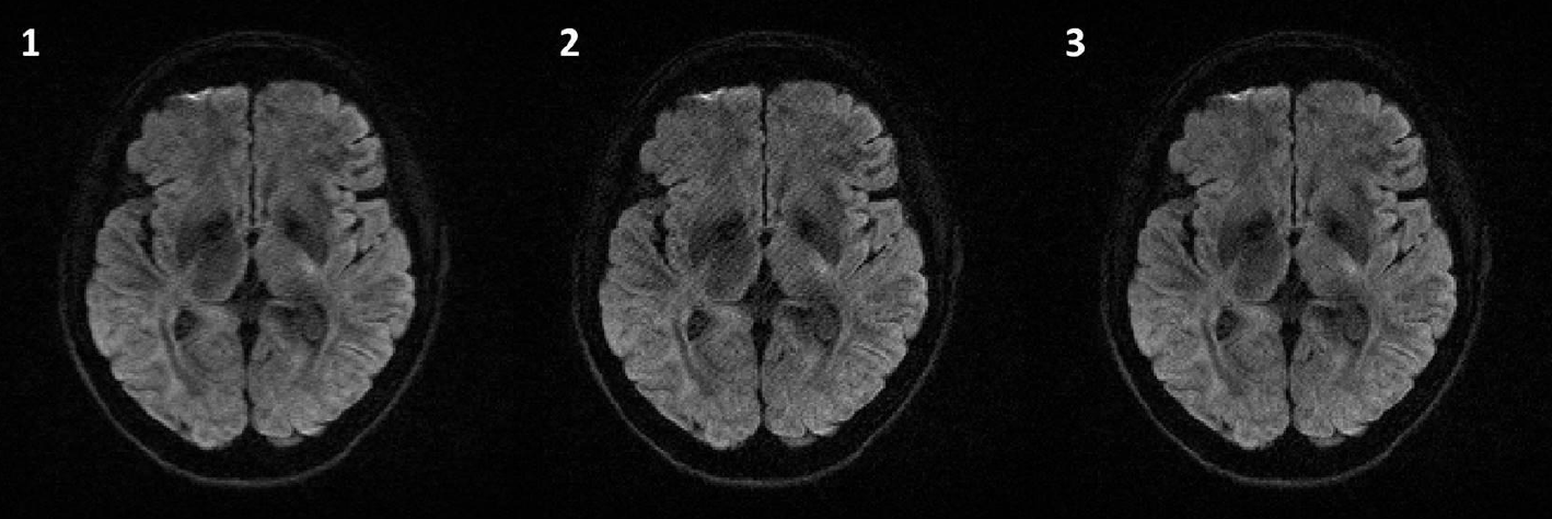 Deep Learning-based image correction for Diffusion Weighted Imaging ...