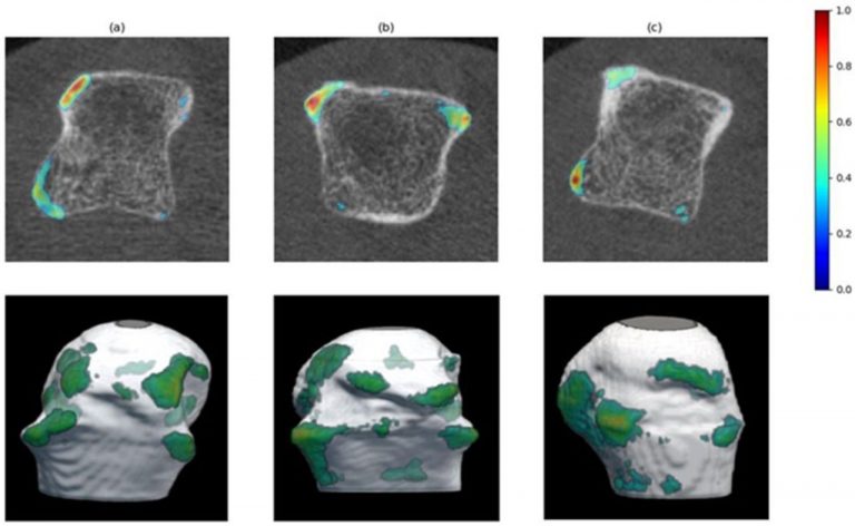 RheumNow article reviews recent work from LME and UK Erlangen