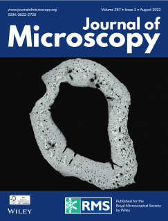 Zum Artikel "Pattern Recognition Lab featured on the Cover of the Journal of Microscopy"