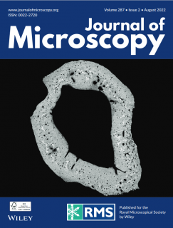 Towards entry "Pattern Recognition Lab featured on the Cover of the Journal of Microscopy"