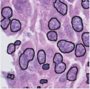 Zum Artikel "Invited Talk: Prof. Dr. Thomas Walter, École des Mines de Paris – Computer vision for histopathology and spatial transcriptomics, Thu, Jan 23rd, 2025, 11 AM CET"